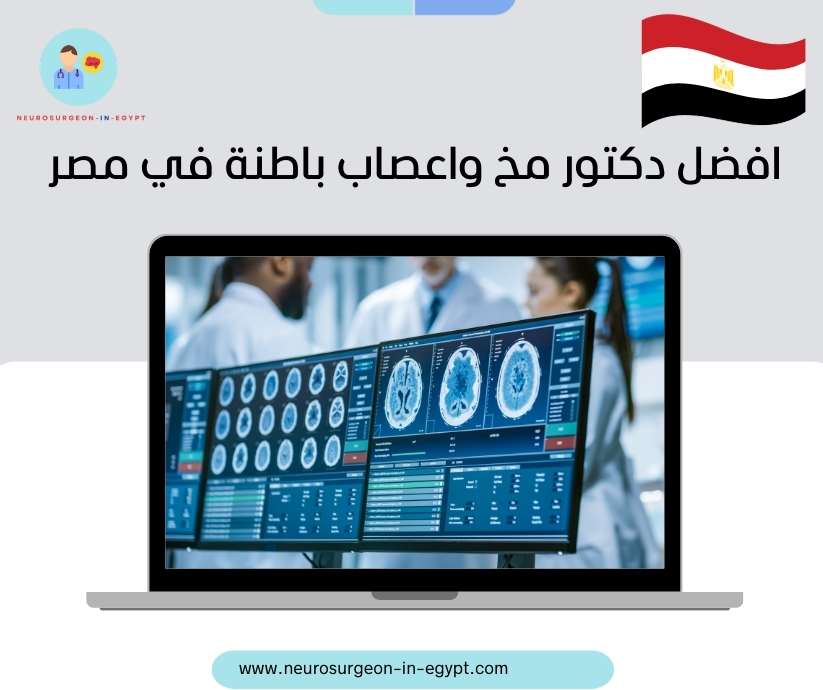 افضل دكتور مخ واعصاب باطنة في مصر