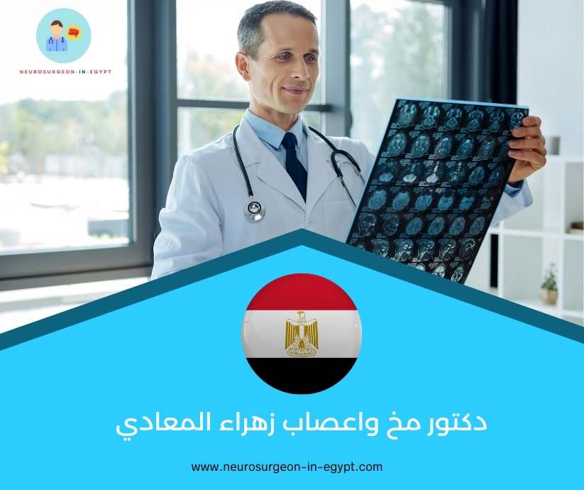دكتور مخ واعصاب زهراء المعادي