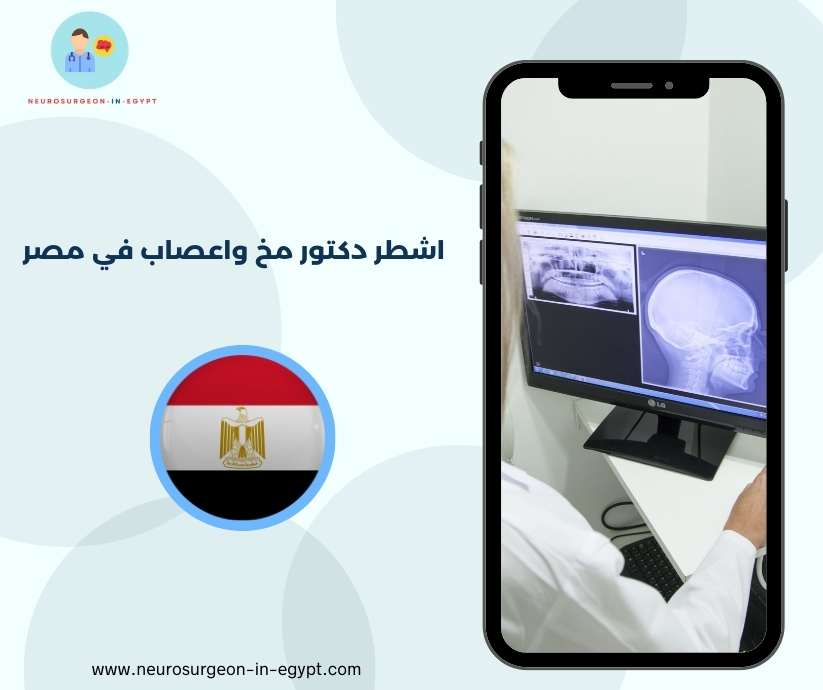 اشطر دكتور مخ واعصاب في مصر