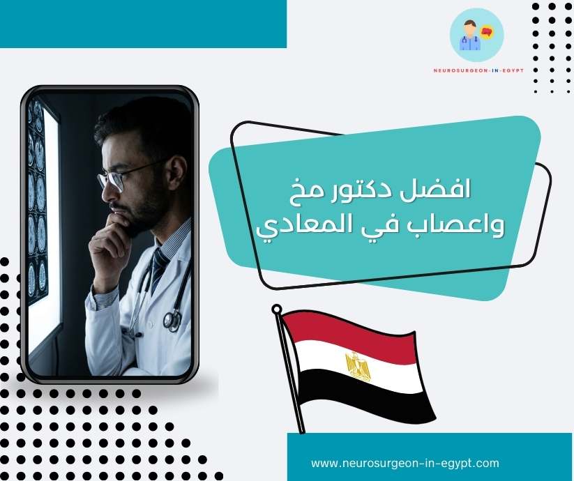 افضل دكتور مخ واعصاب في المعادي