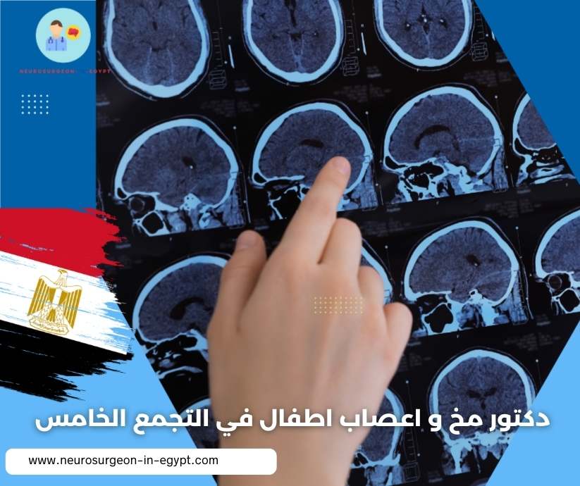 دكتور مخ و اعصاب اطفال في التجمع الخامس