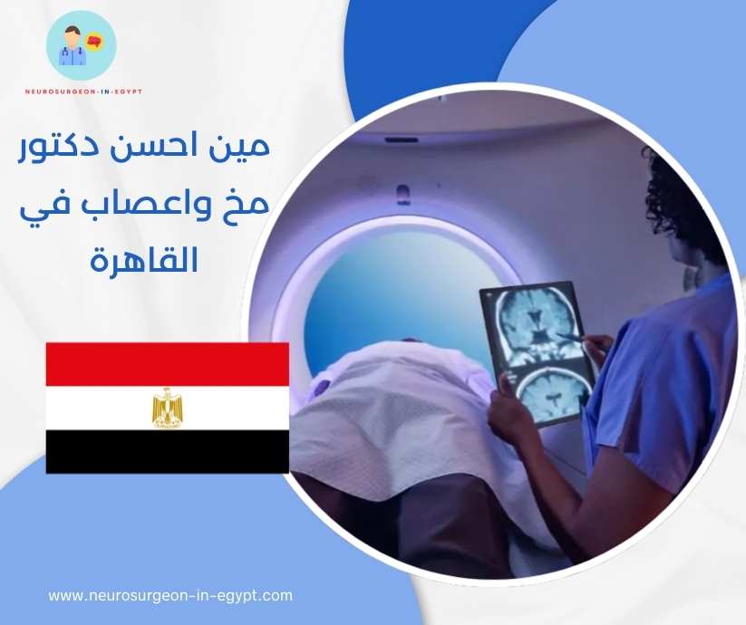 مين احسن دكتور مخ واعصاب في القاهرة