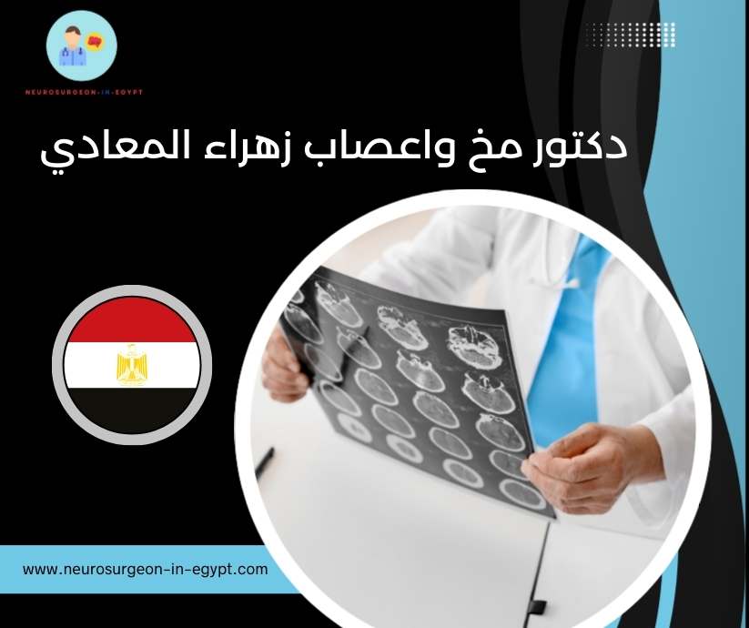 دكتور مخ واعصاب زهراء المعادي