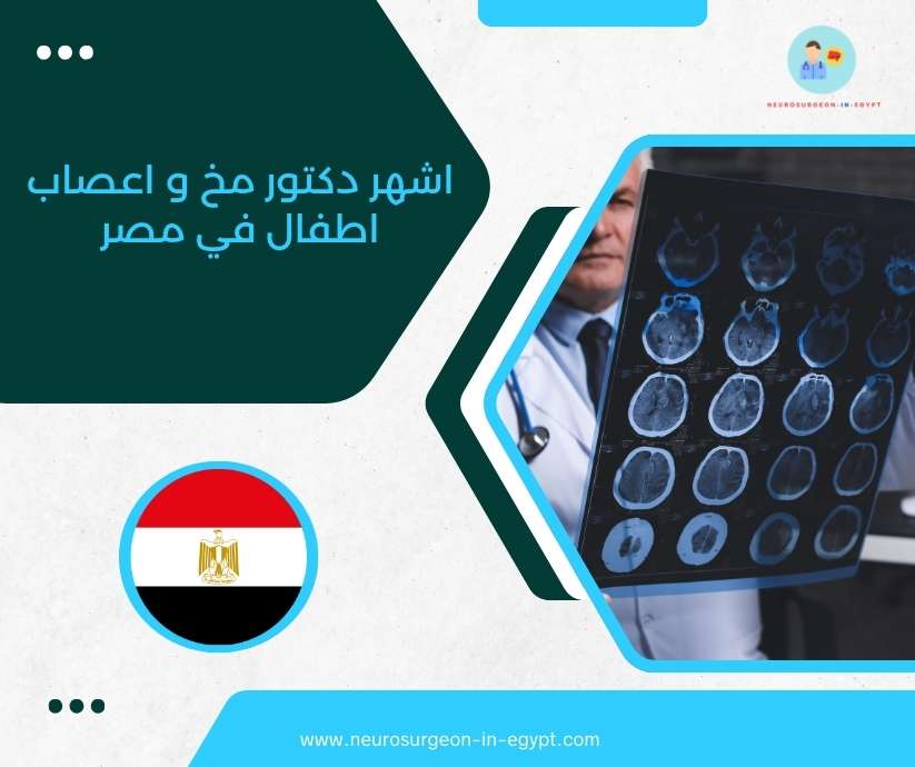 اشهر دكتور مخ و اعصاب اطفال في مصر