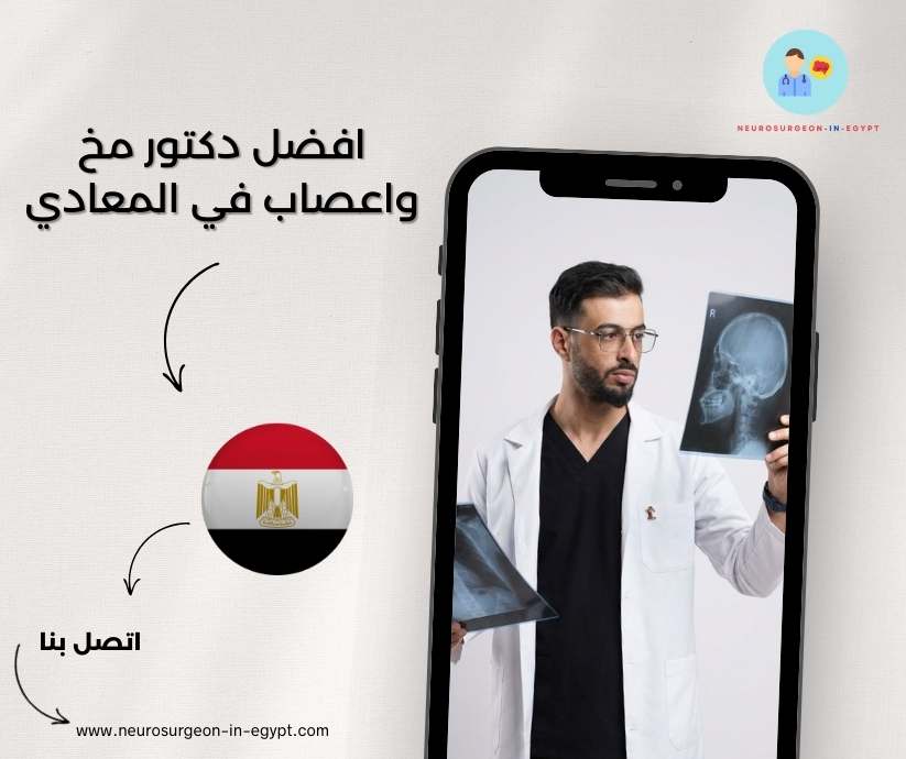 افضل دكتور مخ واعصاب في المعادي