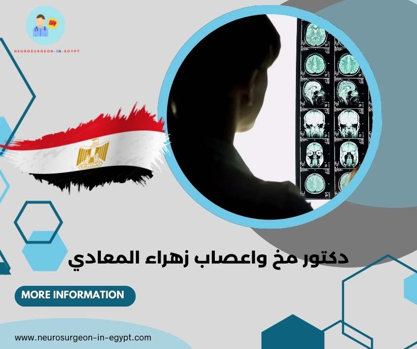 دكتور مخ واعصاب زهراء المعادي