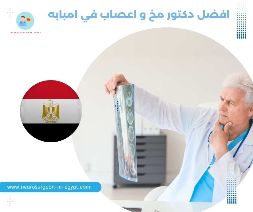 افضل دكتور مخ و اعصاب في امبابه