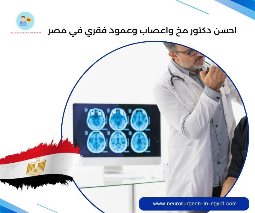 احسن دكتور مخ واعصاب وعمود فقري في مصر
