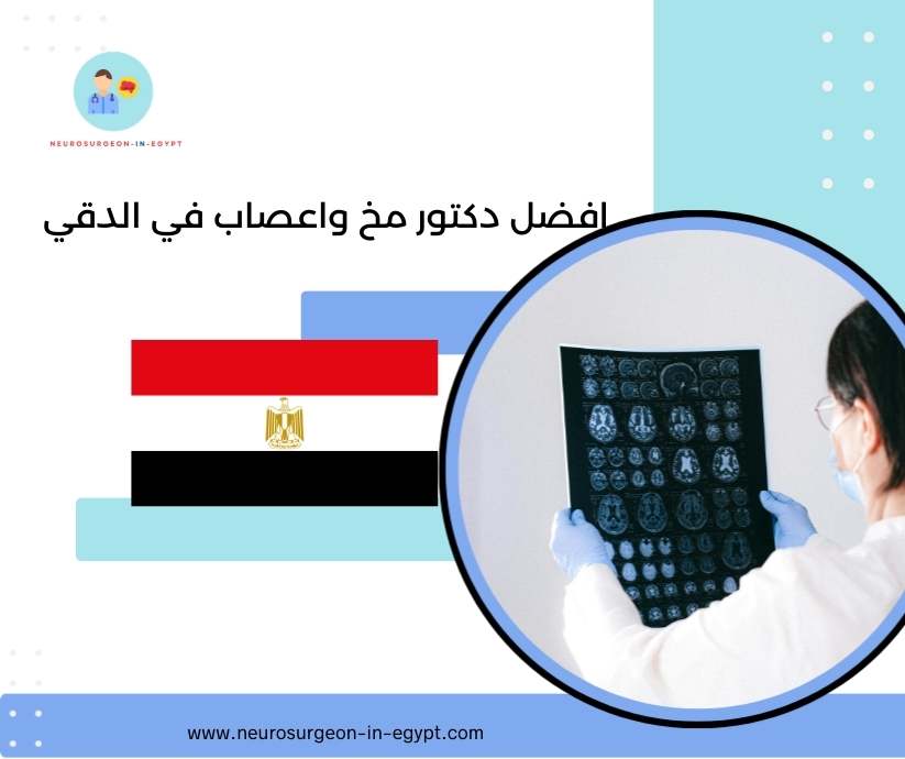افضل دكتور مخ واعصاب في الدقي