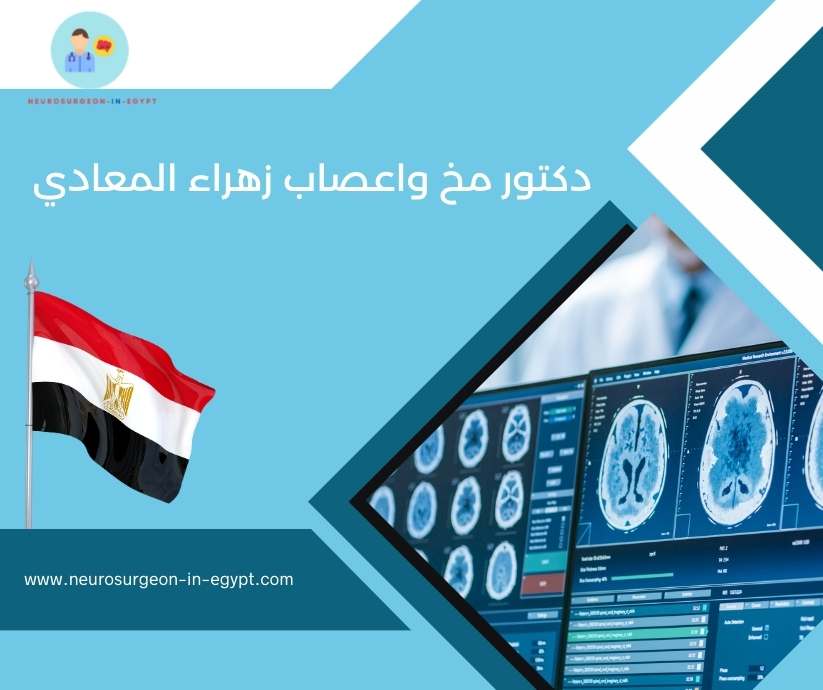 دكتور مخ واعصاب زهراء المعادي
