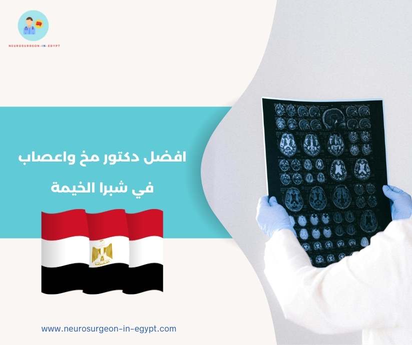 افضل دكتور مخ واعصاب في شبرا الخيمة