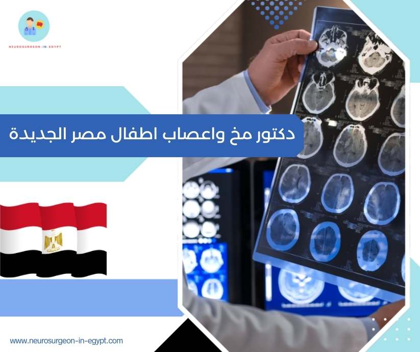 دكتور مخ واعصاب اطفال مصر الجديدة