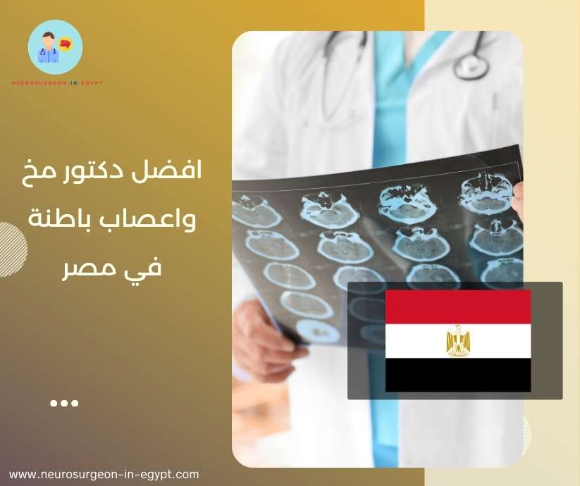 افضل دكتور مخ واعصاب باطنة في مصر