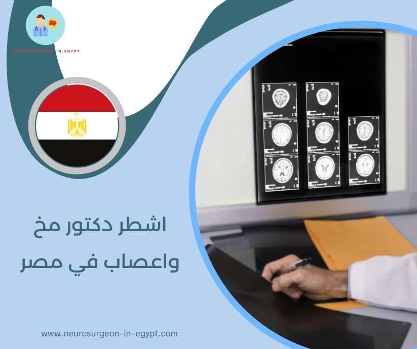 اشطر دكتور مخ واعصاب في مصر