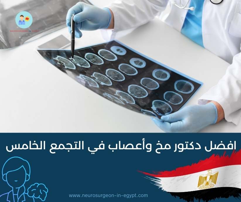 افضل دكتور مخ وأعصاب في التجمع الخامس