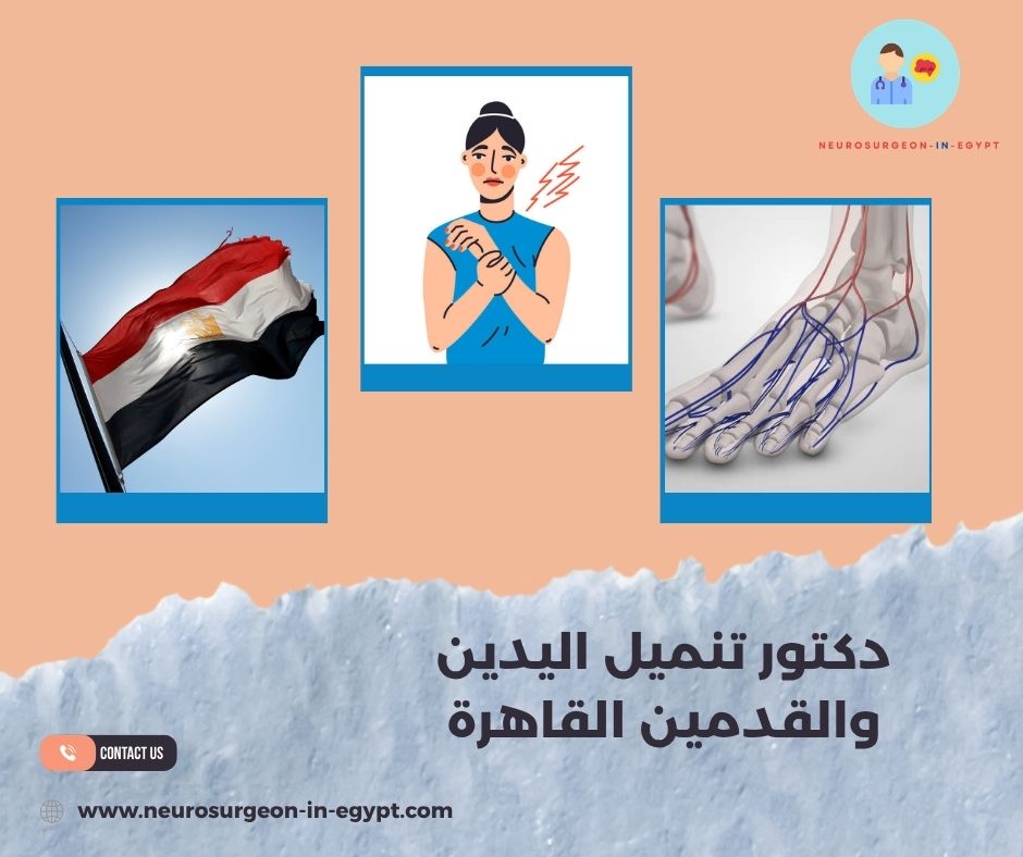 دكتور تنميل اليدين والقدمين القاهرة