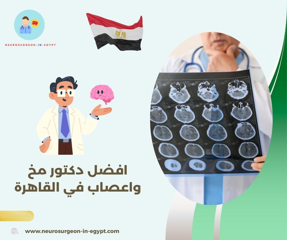 افضل دكتور مخ واعصاب في القاهرة
