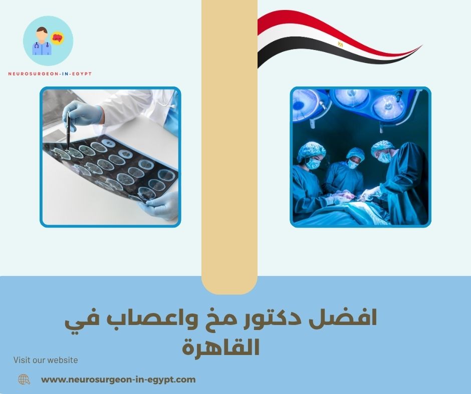 افضل دكتور مخ واعصاب في القاهرة