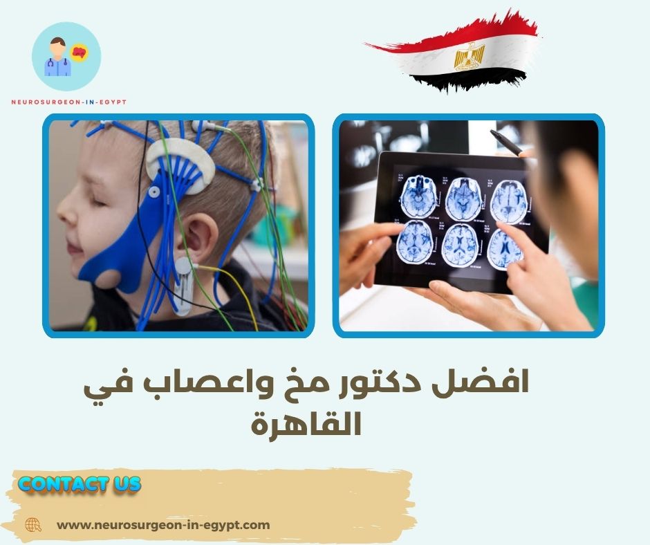 افضل دكتور مخ واعصاب في القاهرة
