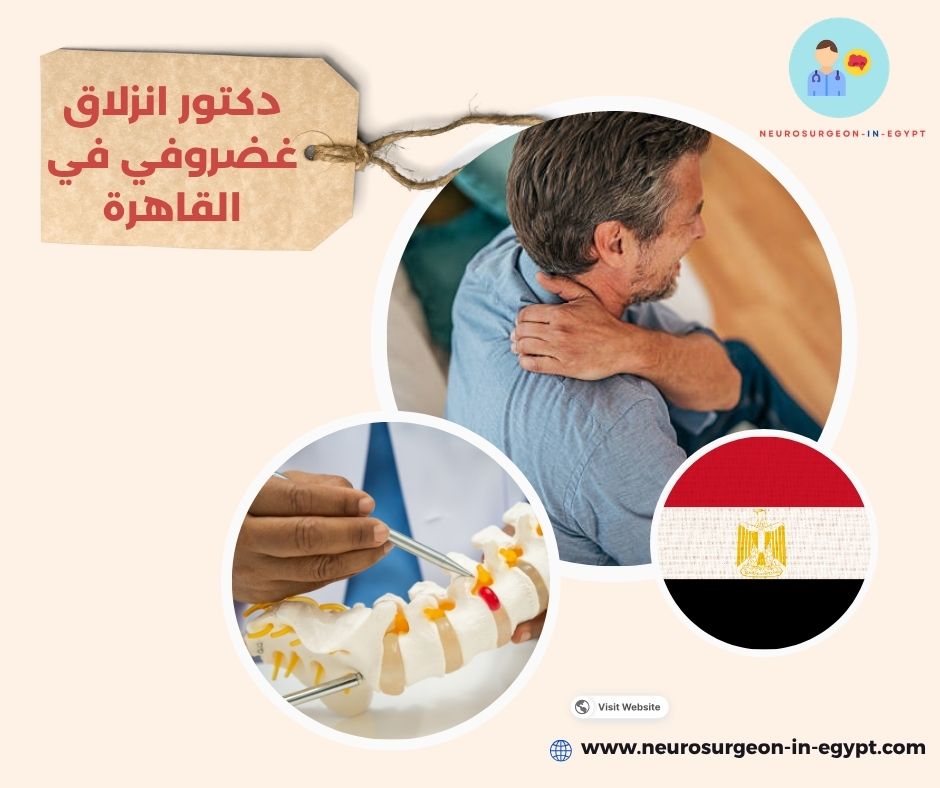 دكتور انزلاق غضروفي في القاهرة
