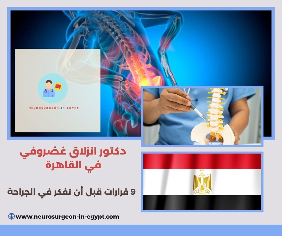 دكتور انزلاق غضروفي في القاهرة