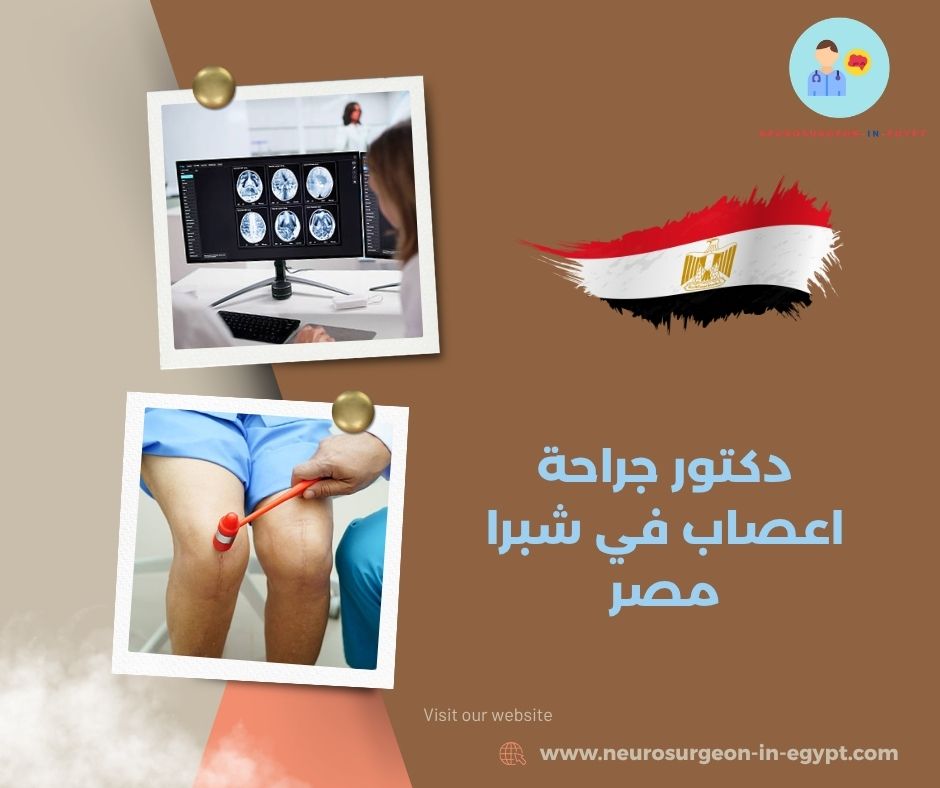 دكتور جراحة اعصاب في شبرا مصر