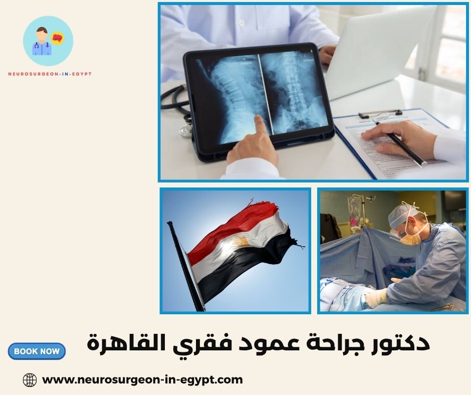 دكتور جراحة عمود فقري القاهرة
