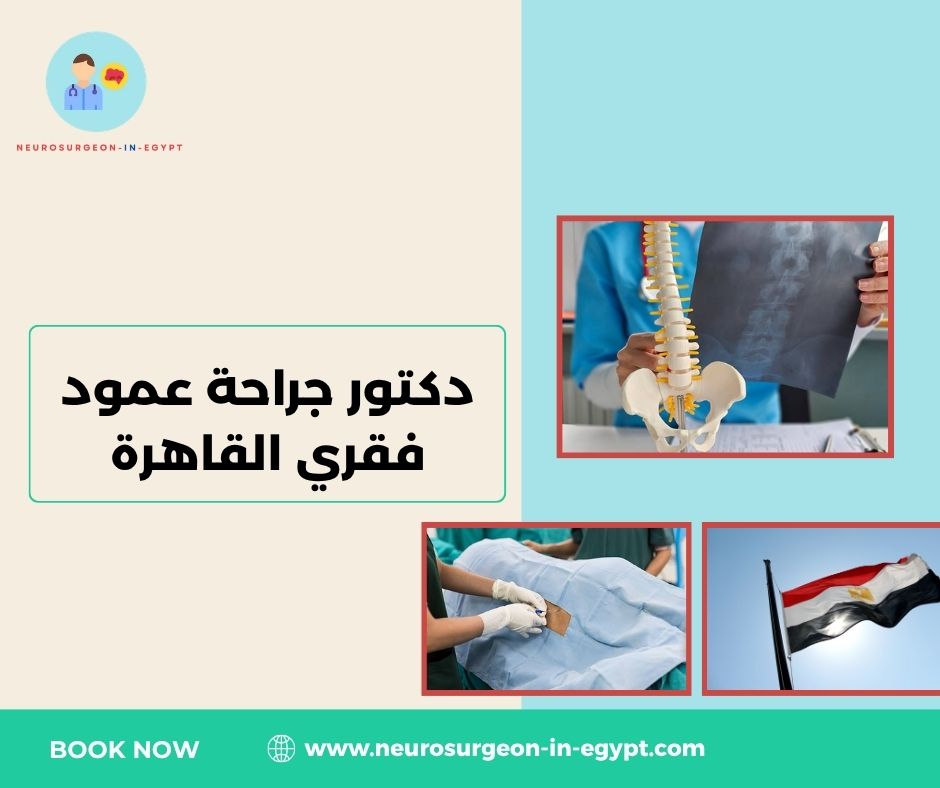 دكتور جراحة عمود فقري القاهرة