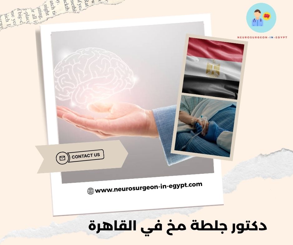 دكتور جلطة مخ في القاهرة
