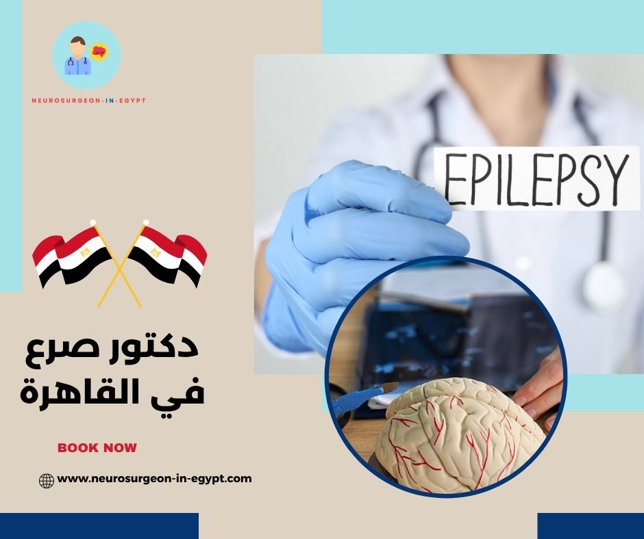 دكتور صرع في القاهرة
