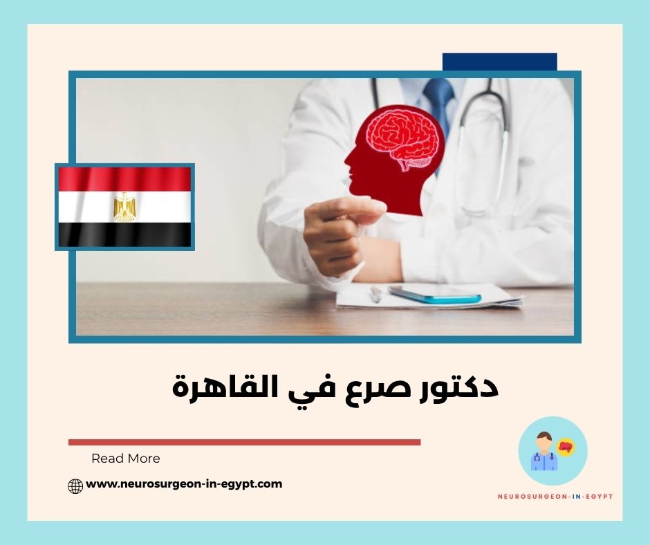 دكتور صرع في القاهرة
