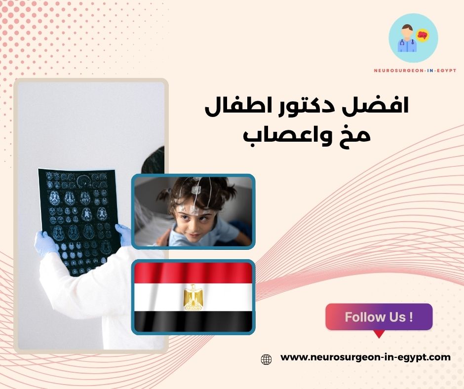 افضل دكتور اطفال مخ واعصاب