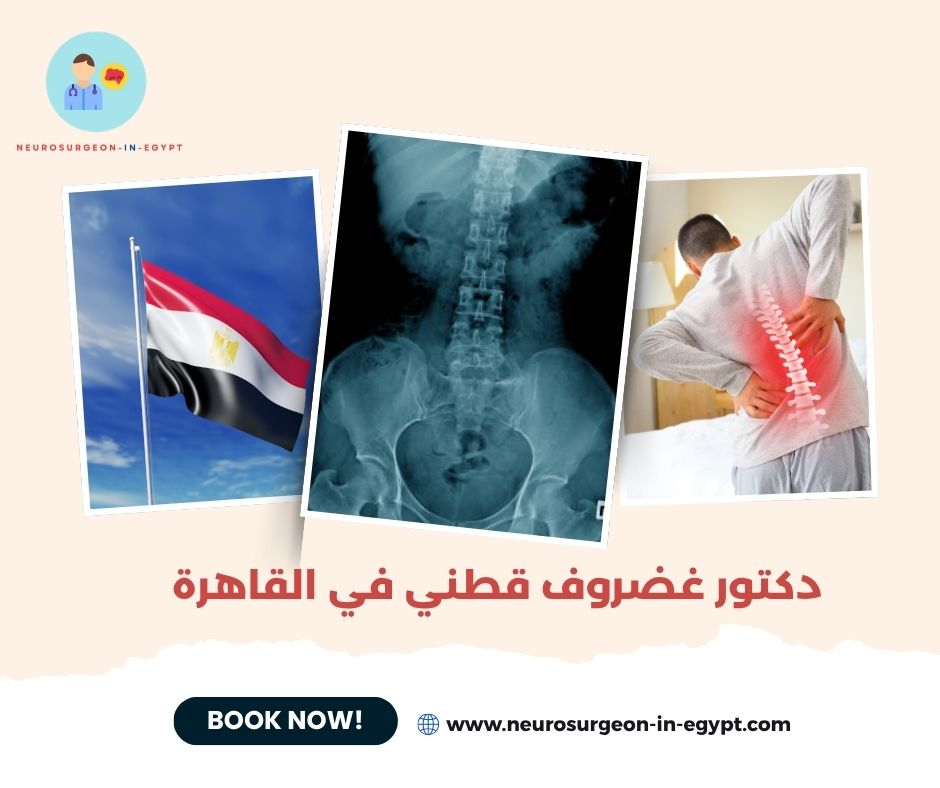 دكتور غضروف قطني في القاهرة