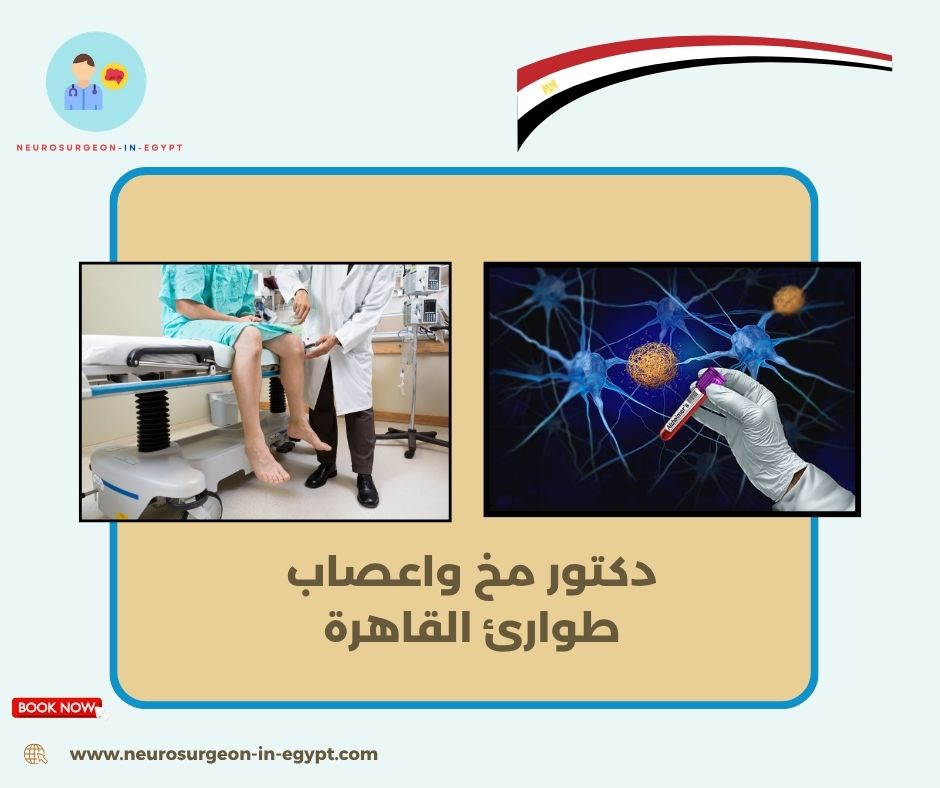 دكتور مخ واعصاب طوارئ القاهرة