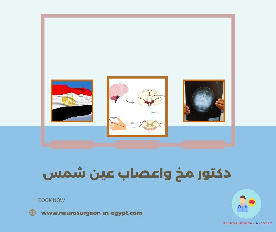 دكتور مخ واعصاب عين شمس