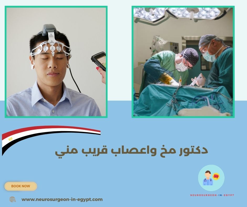 دكتور مخ واعصاب قريب مني