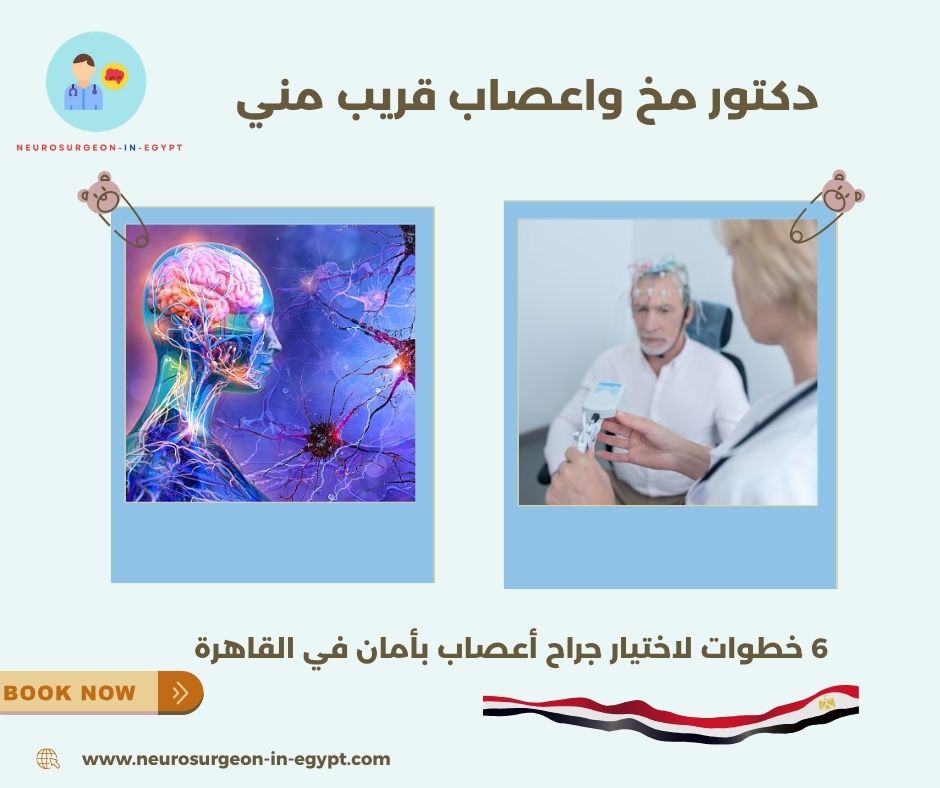 دكتور مخ واعصاب قريب مني