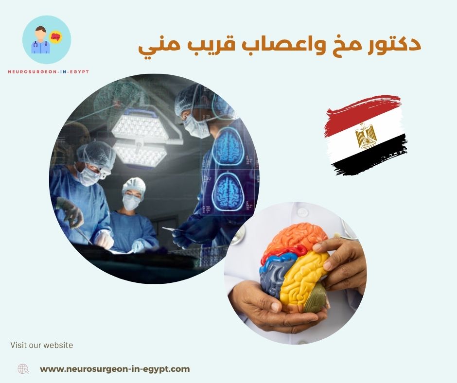 دكتور مخ واعصاب قريب مني