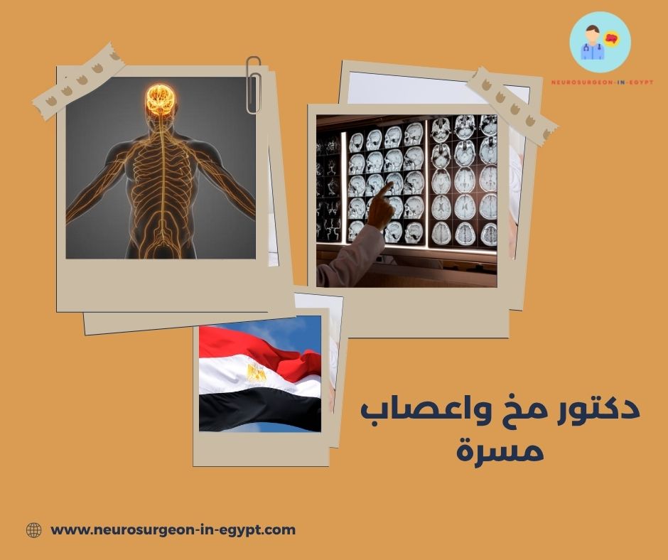 دكتور مخ واعصاب مسرة