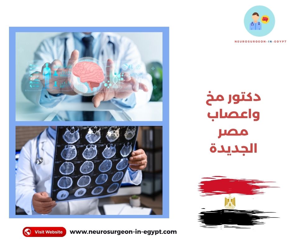 دكتور مخ واعصاب مصر الجديدة