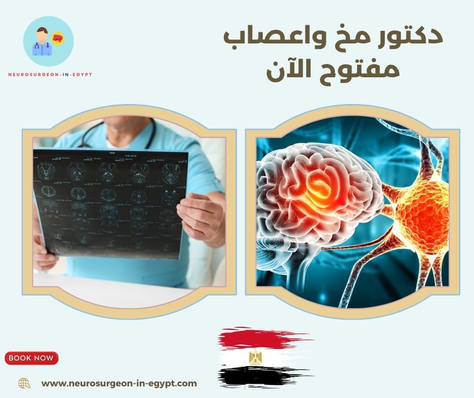 دكتور مخ واعصاب مفتوح الآن
