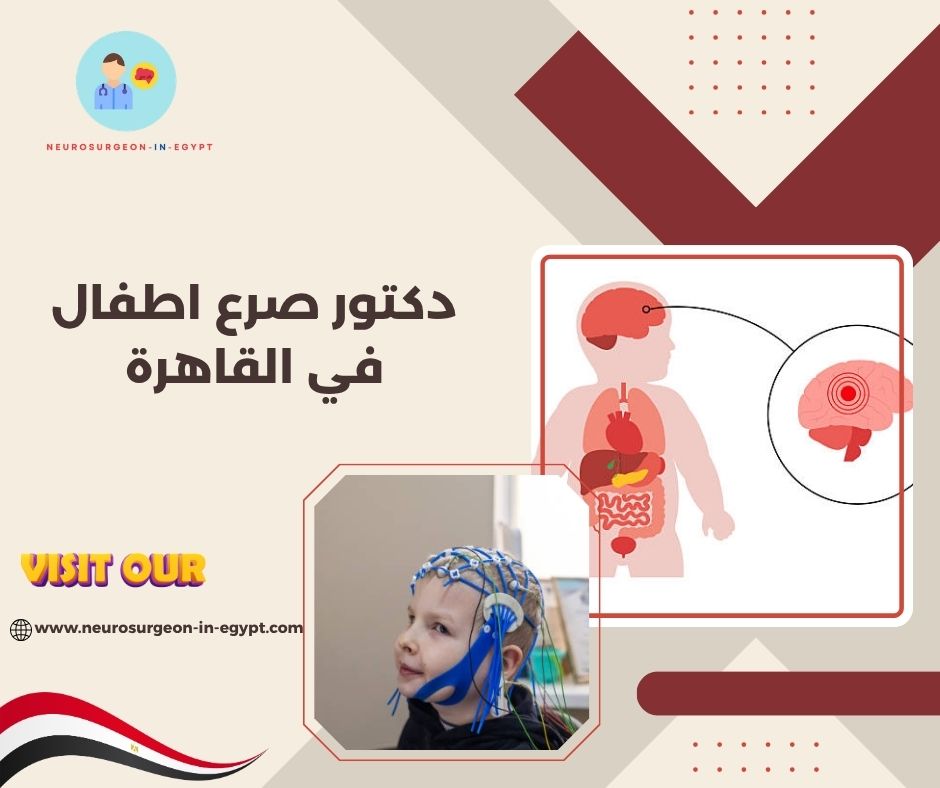 دكتور صرع اطفال في القاهرة