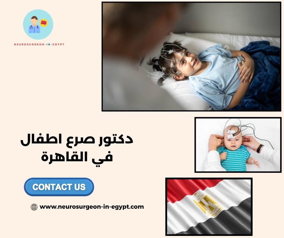 دكتور صرع اطفال في القاهرة