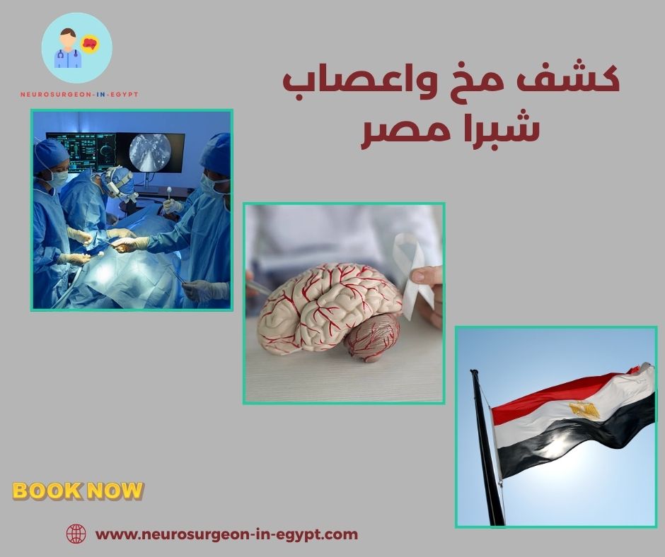 كشف مخ واعصاب شبرا مصر