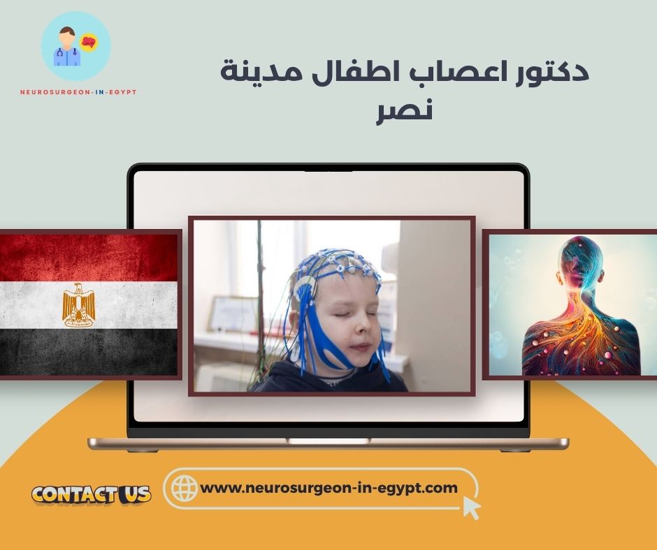 دكتور اعصاب اطفال مدينة نصر