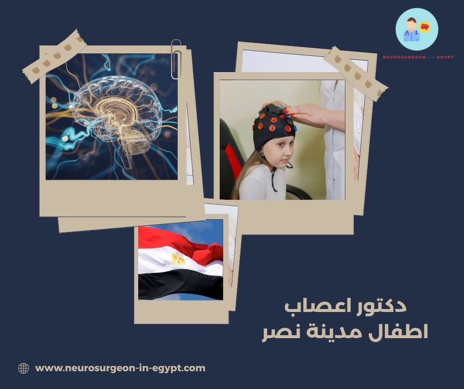 دكتور اعصاب اطفال مدينة نصر