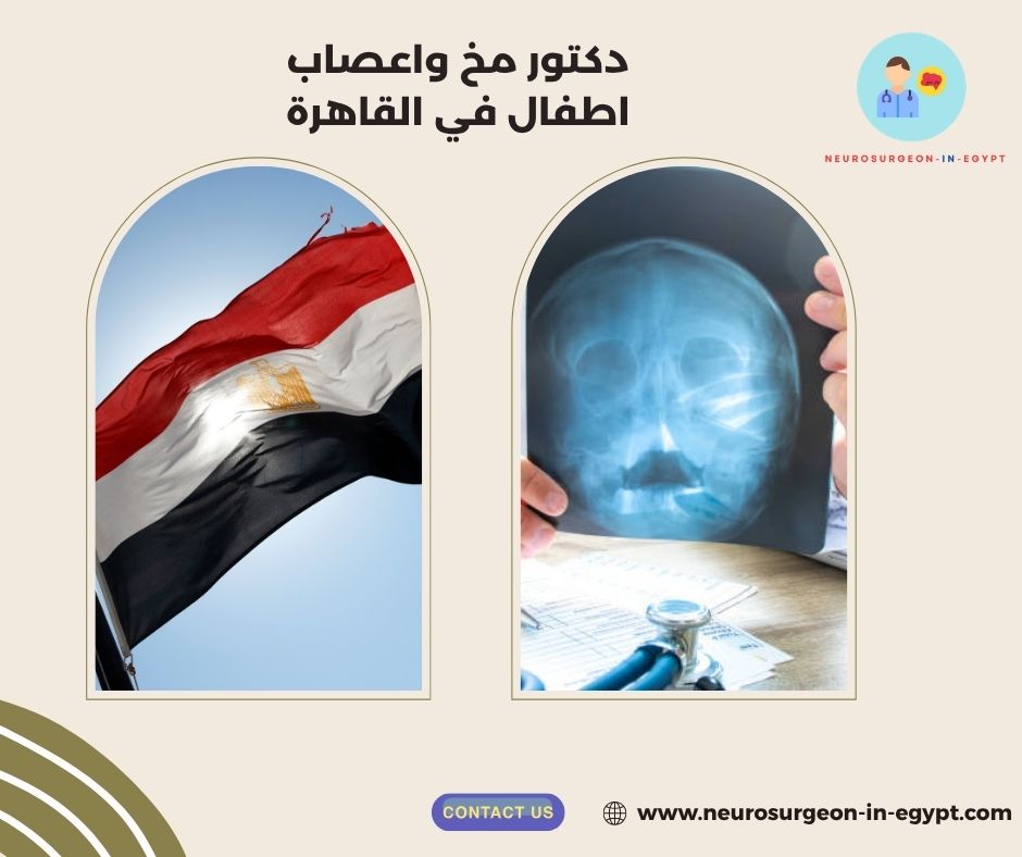 دكتور مخ واعصاب اطفال في القاهرة