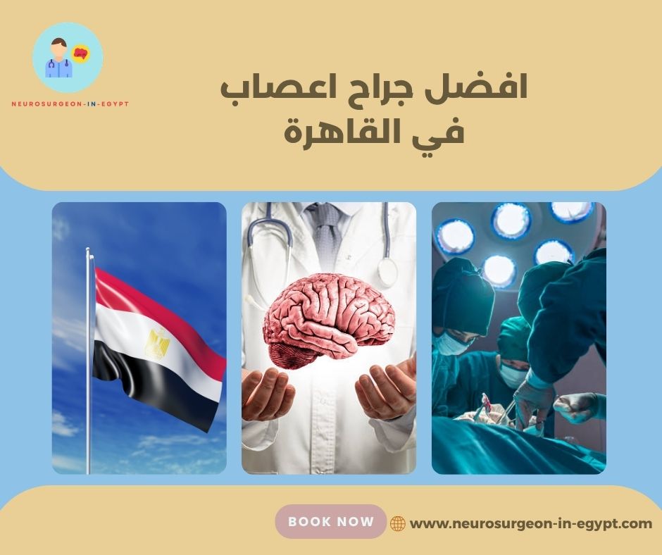افضل جراح اعصاب في القاهرة