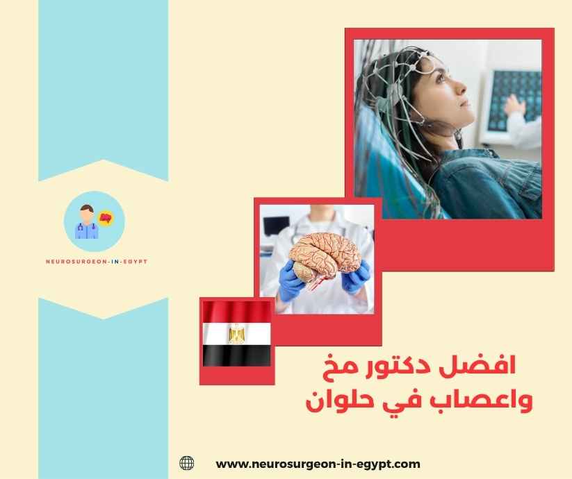 افضل دكتور مخ واعصاب في حلوان