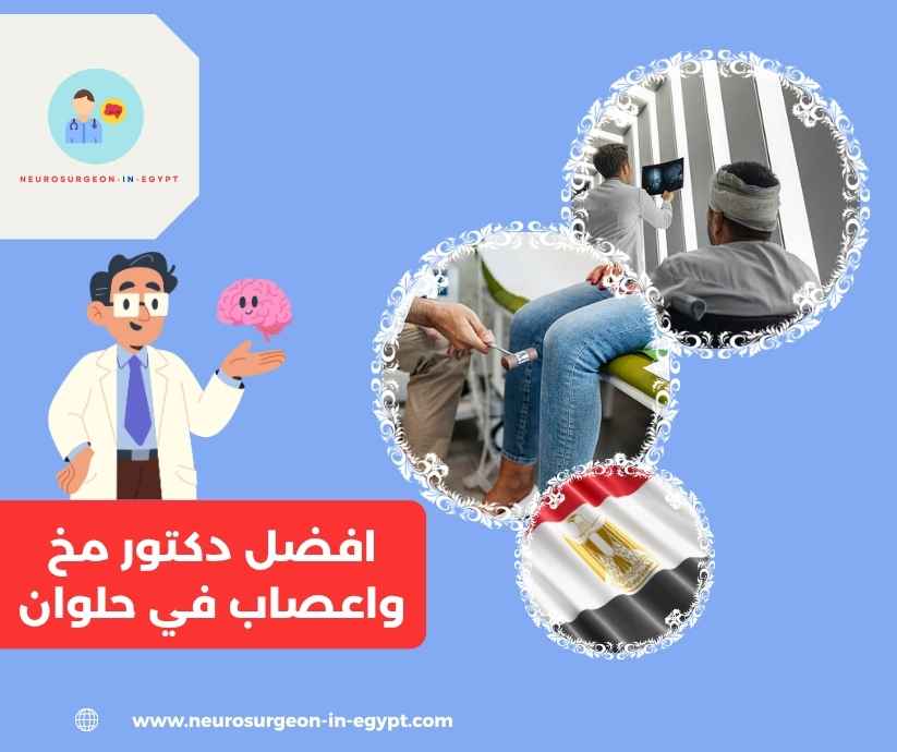 افضل دكتور مخ واعصاب في حلوان